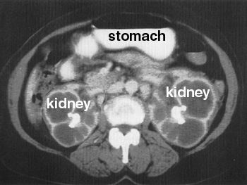 Kidney_zps1c6550da.jpg