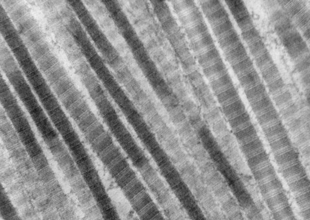 lungfibers.jpg