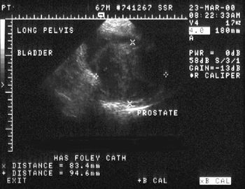 Ultrasound_zps2888c060.jpg