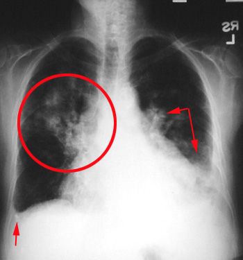 Xray_zps6abc5b84.jpg